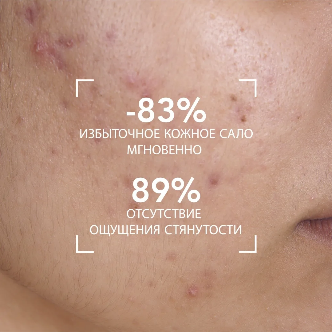 Гель для умывания Bioderma Sebium Moussant 100мл (1220)